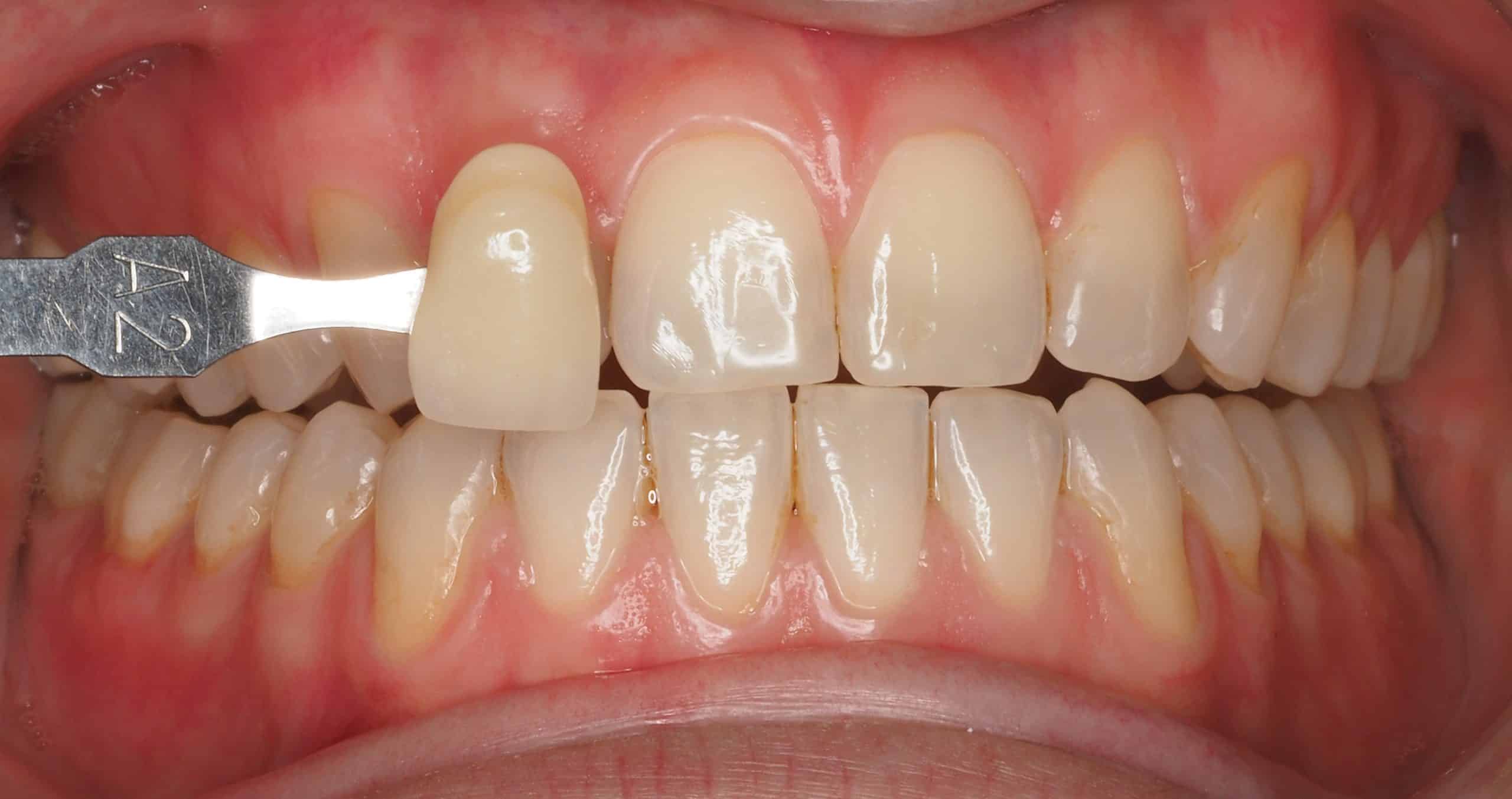 Antes y después - Dr Marc Rovira