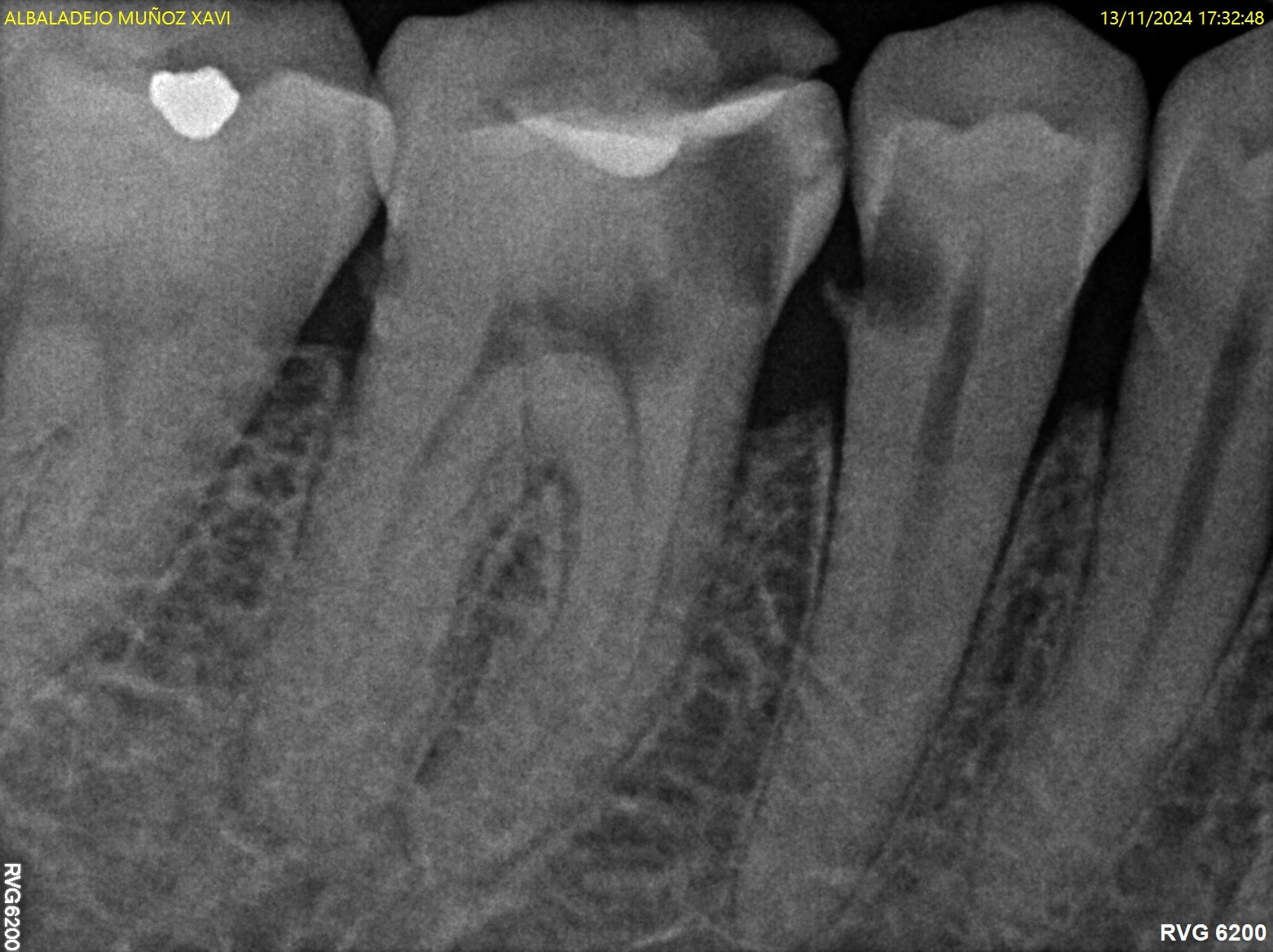 Antes y después - Dr Marc Rovira