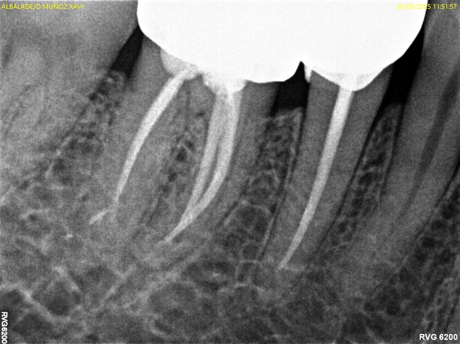 Antes y después - Dr Marc Rovira