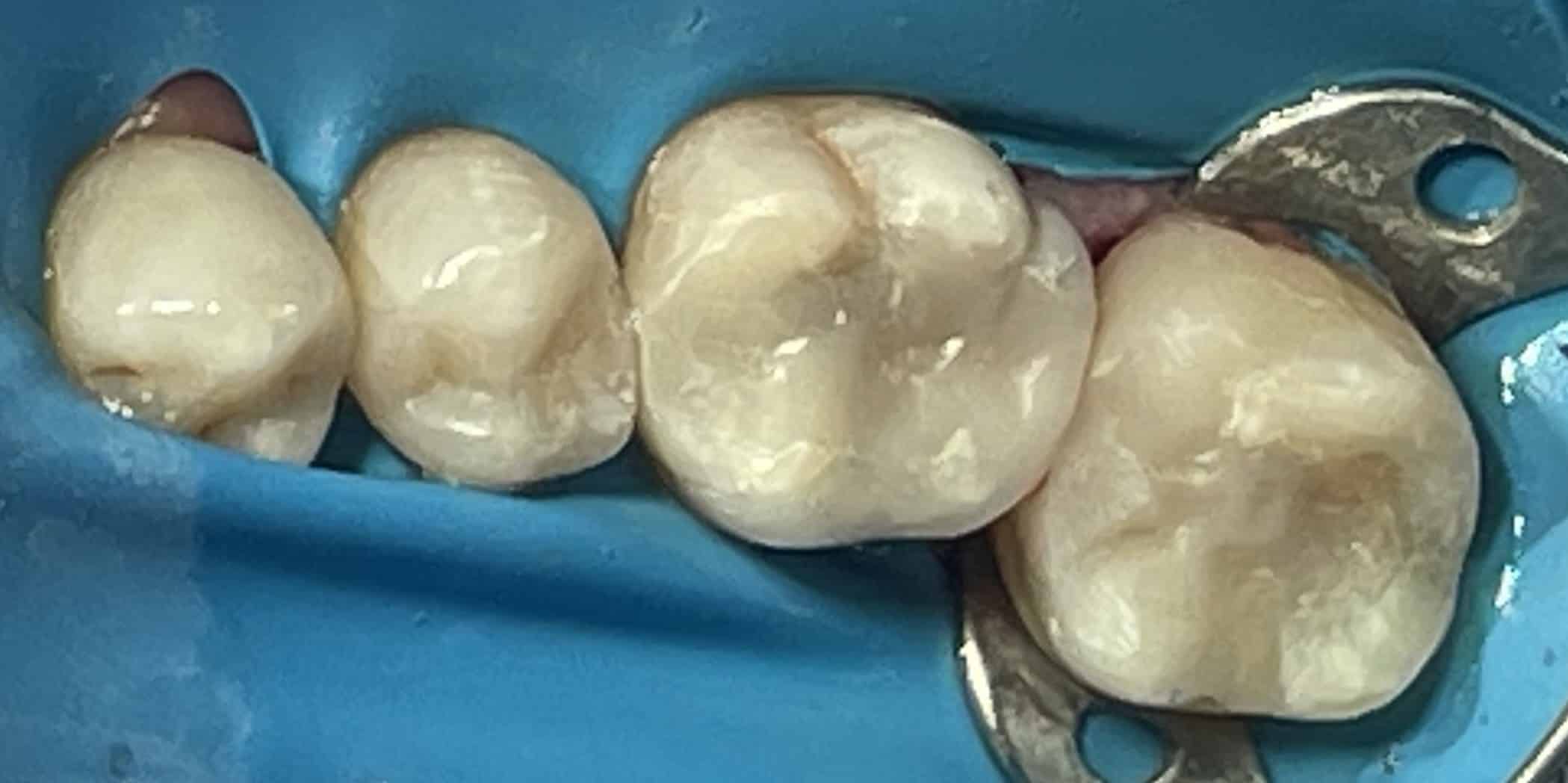 Antes y después - Dr Marc Rovira