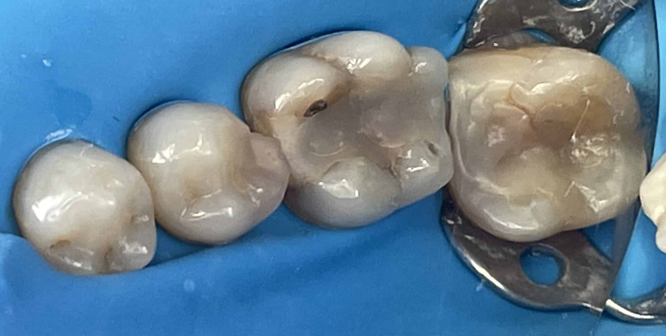 Antes y después - Dr Marc Rovira