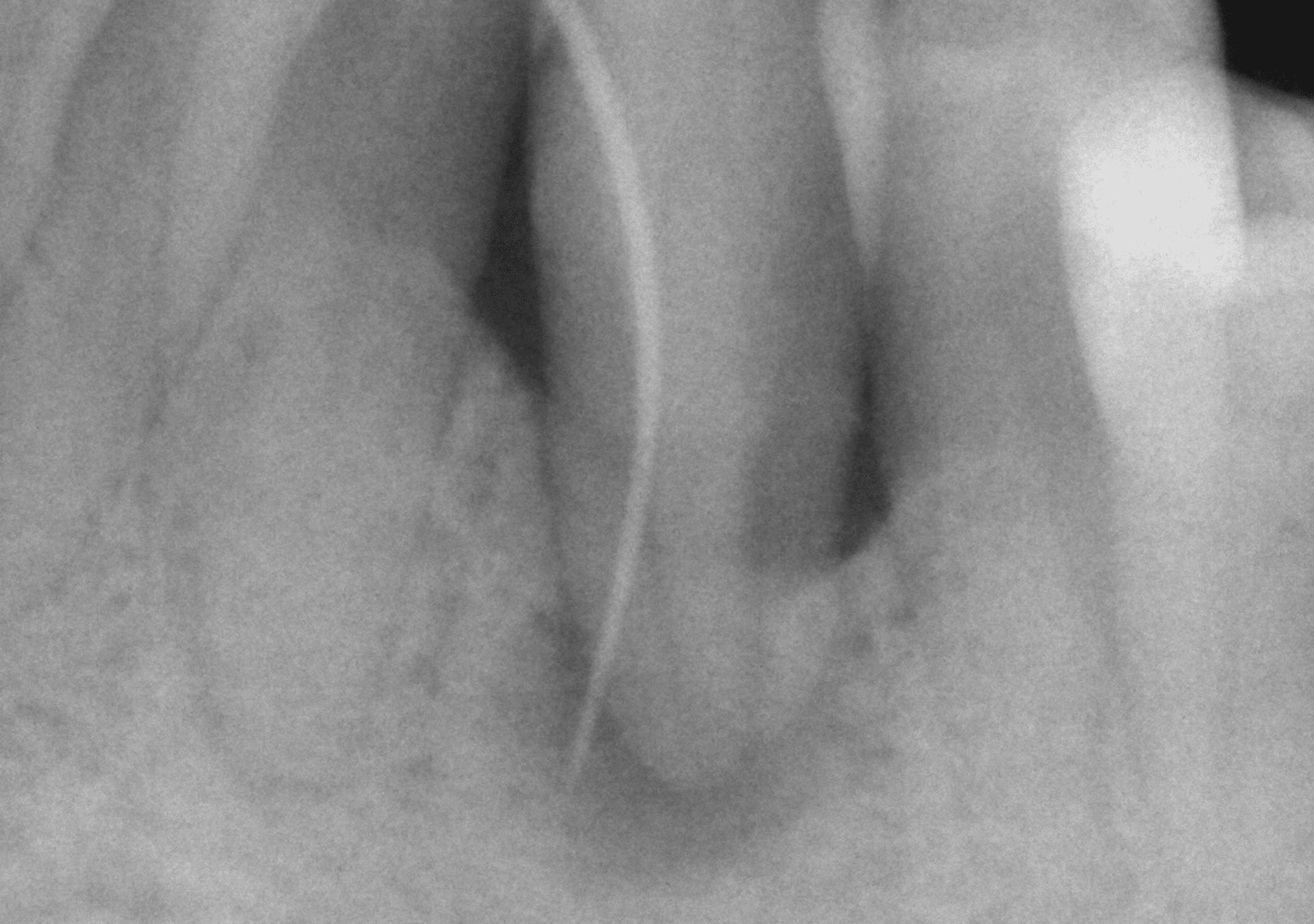 Antes y después - Dr Marc Rovira
