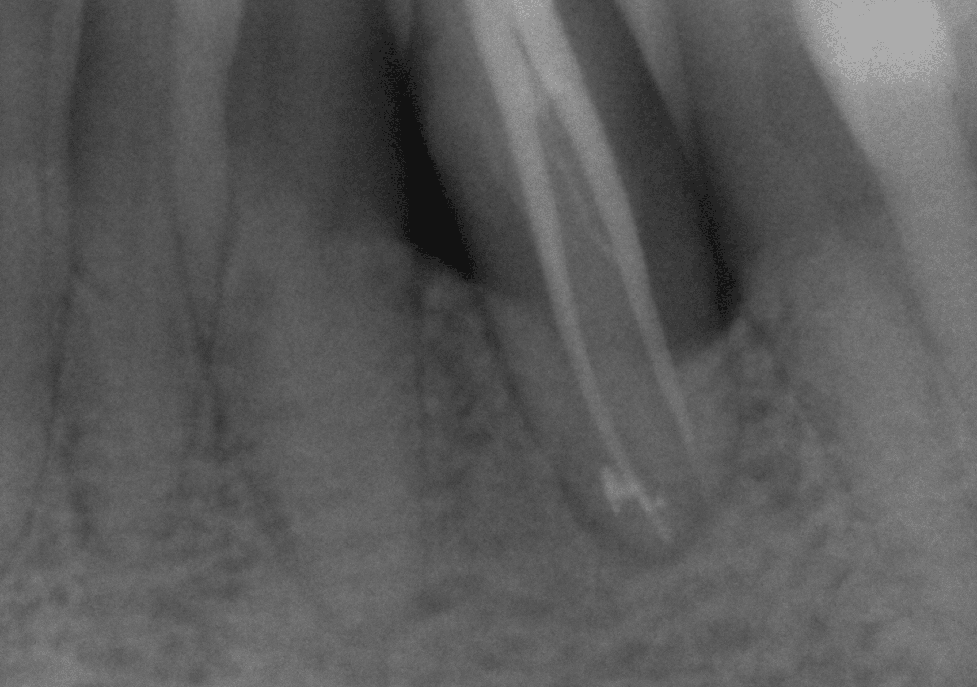 Antes y después - Dr Marc Rovira
