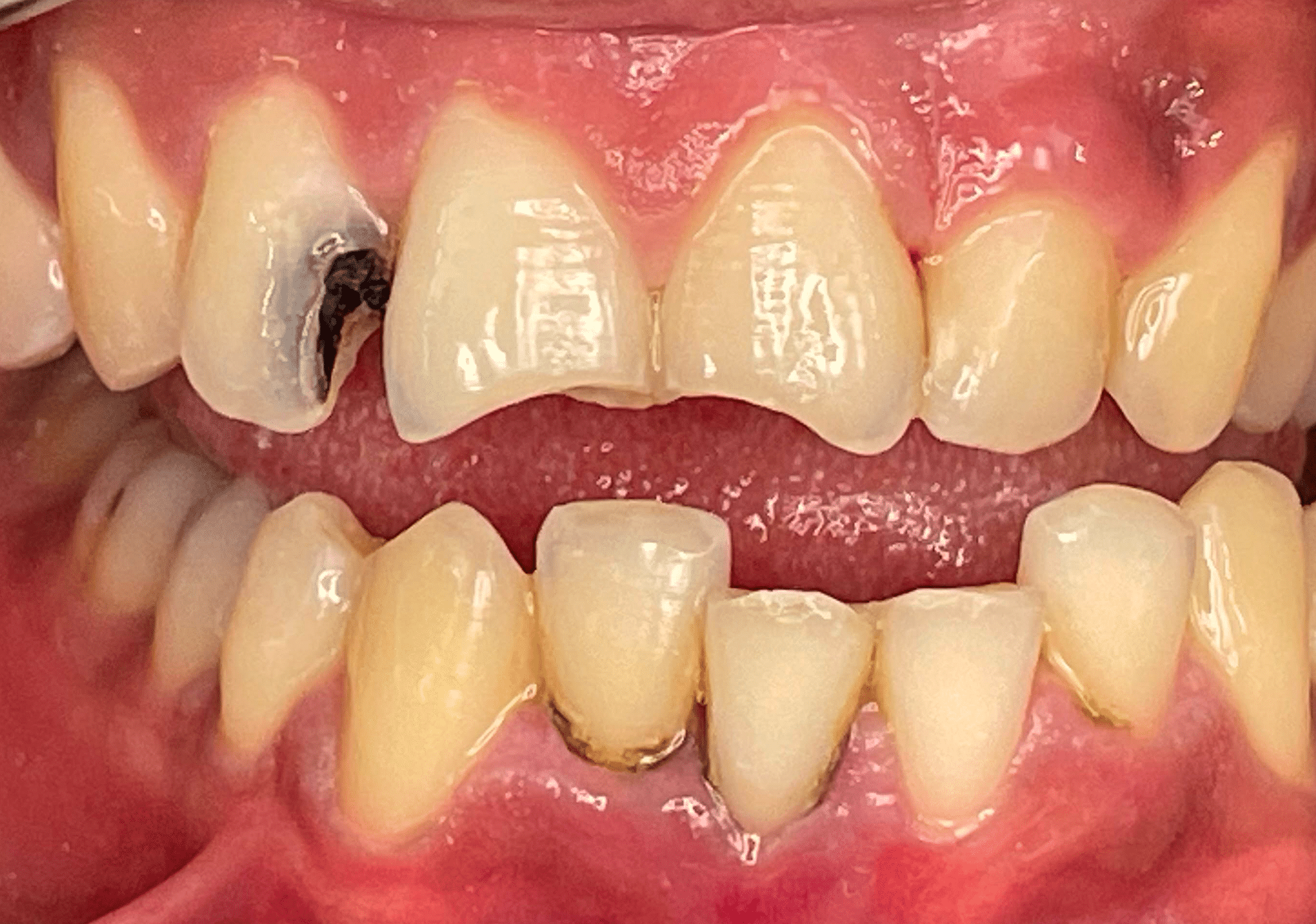 Antes y después - Dr Marc Rovira