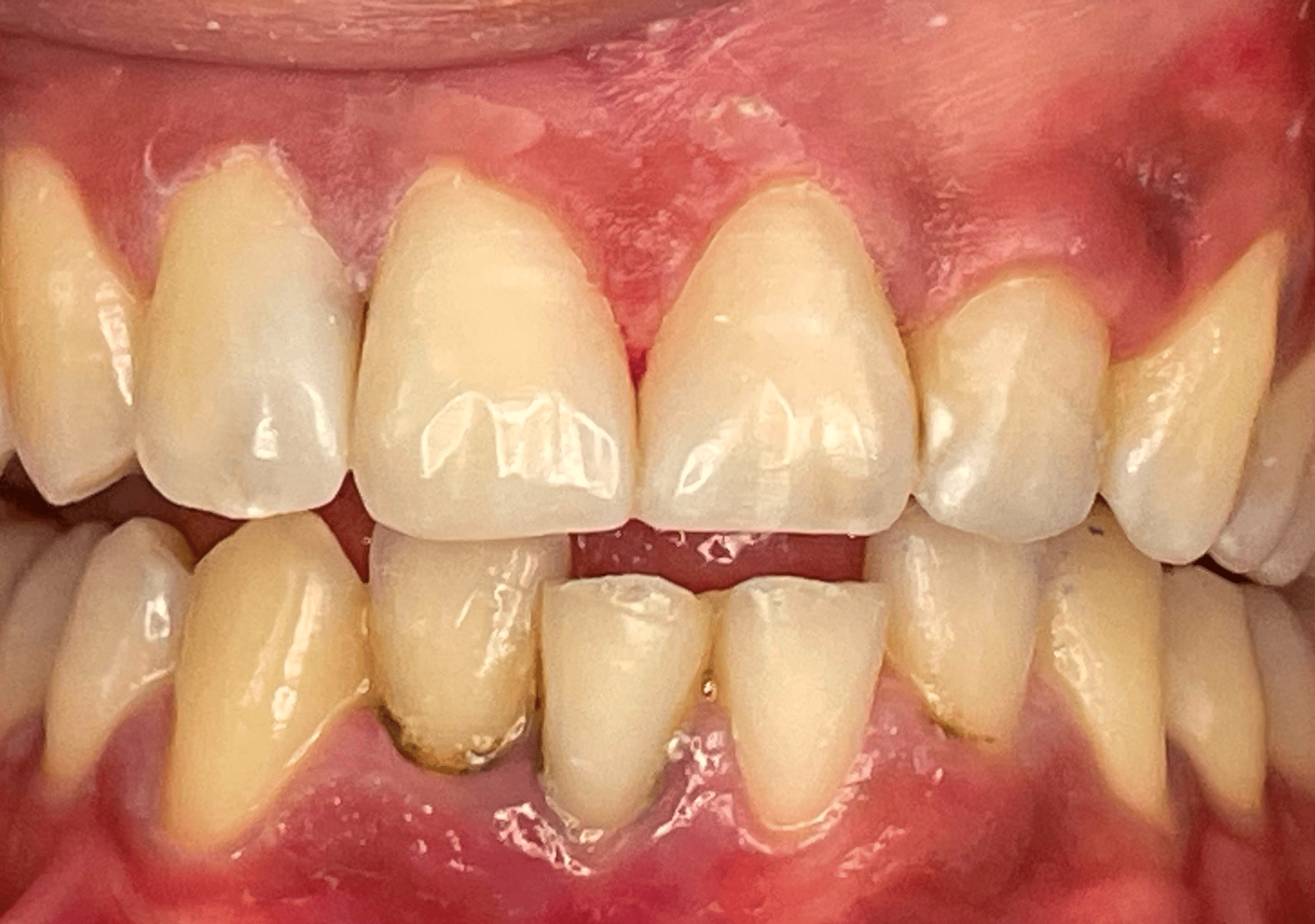 Antes y después - Dr Marc Rovira