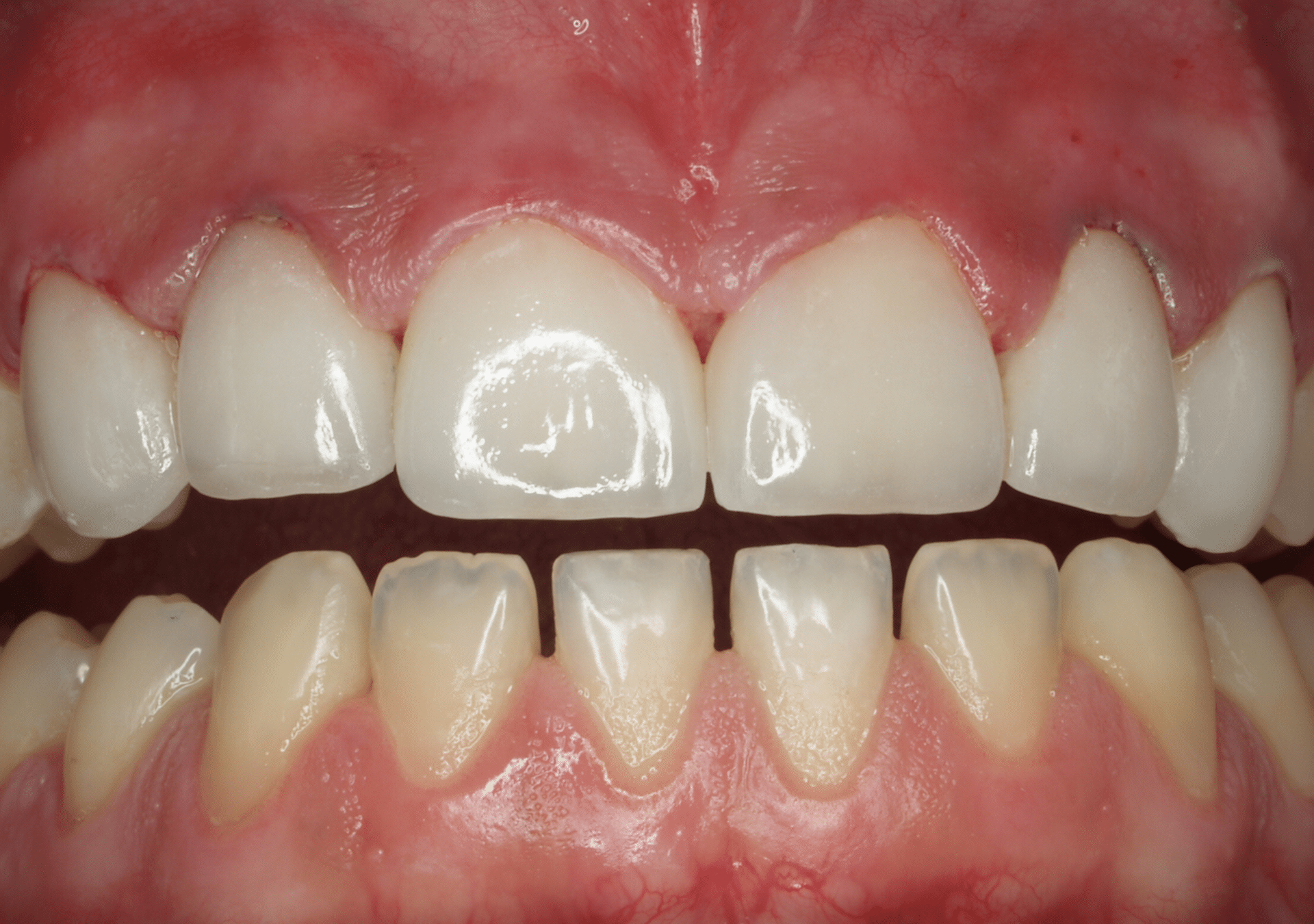 Antes y después - Dr Marc Rovira