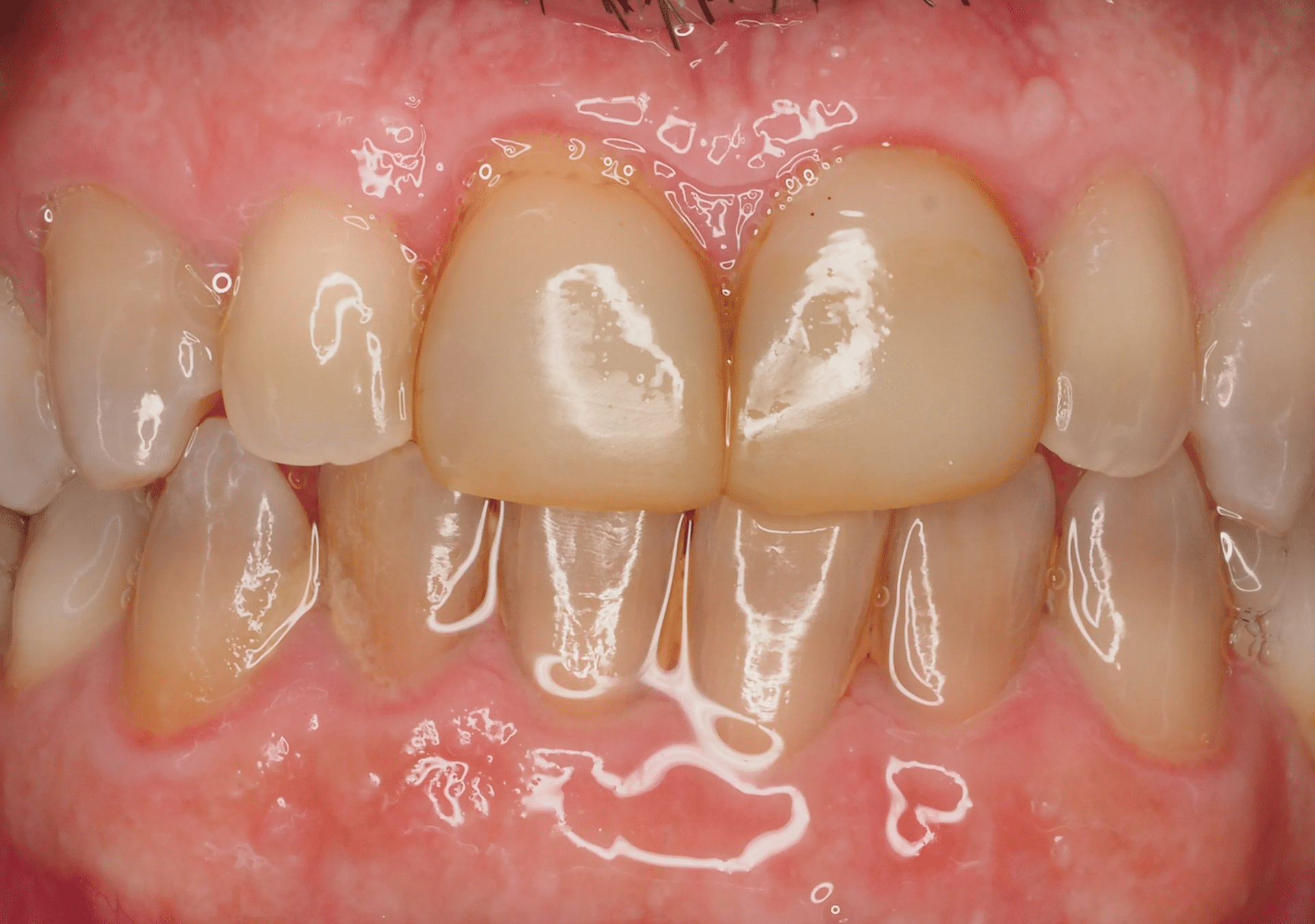 Antes y después - Dr Marc Rovira