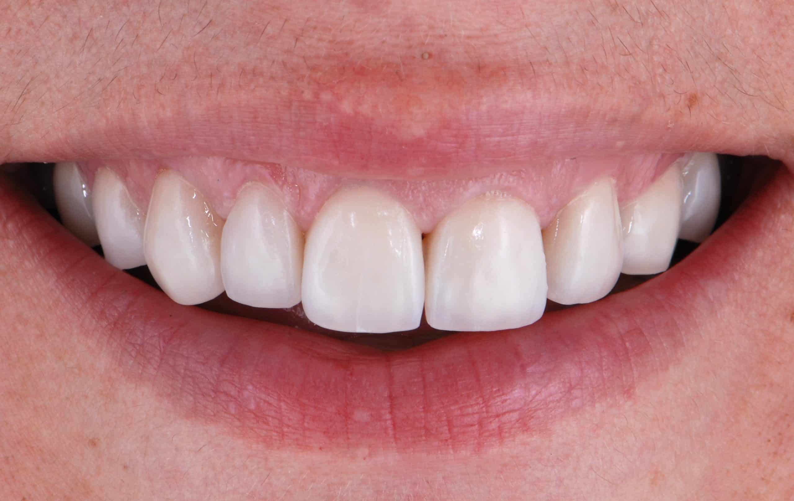 Antes y después - Dr Marc Rovira